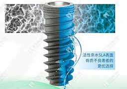 长期稳定不合区的传奇私服